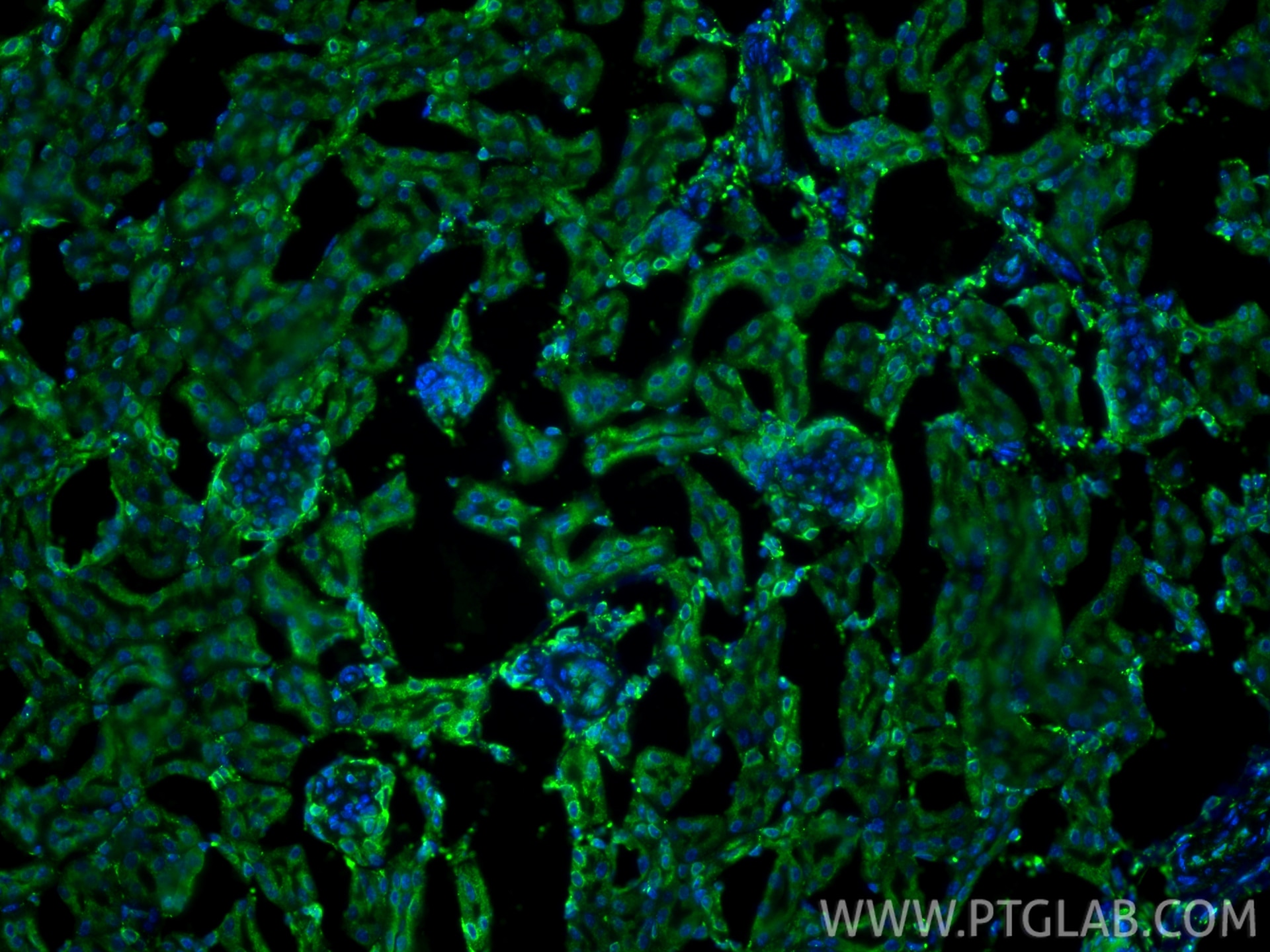 Immunofluorescence (IF) / fluorescent staining of mouse kidney tissue using calreticulin Polyclonal antibody (27298-1-AP)