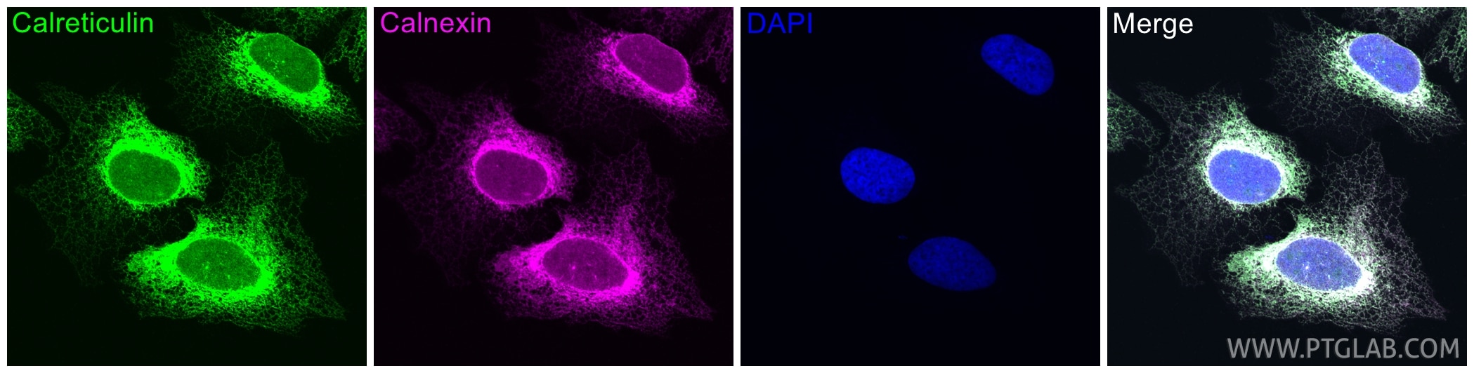 Immunofluorescence (IF) / fluorescent staining of U2OS cells using calreticulin Polyclonal antibody (27298-1-AP)