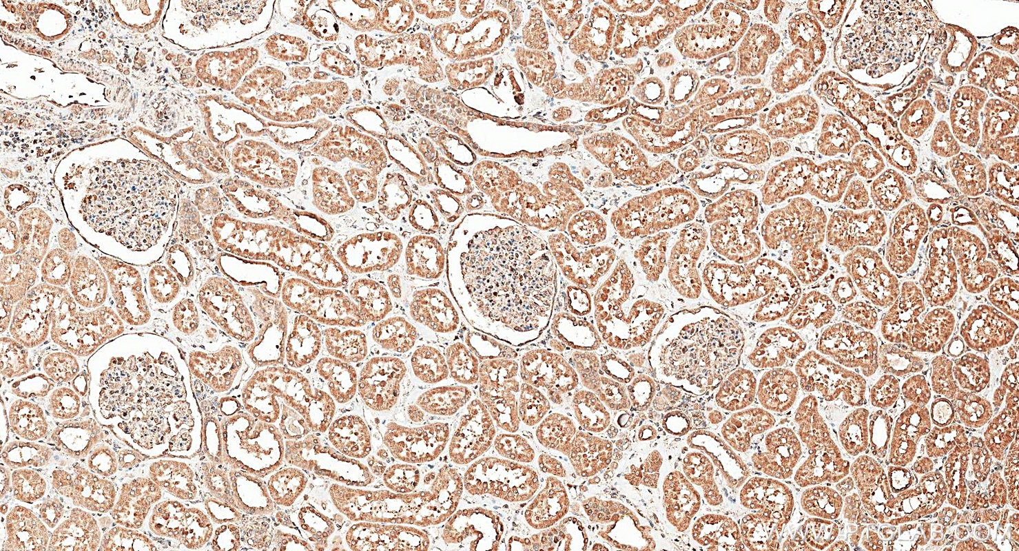 Immunohistochemistry (IHC) staining of human kidney tissue using calreticulin Polyclonal antibody (27298-1-AP)