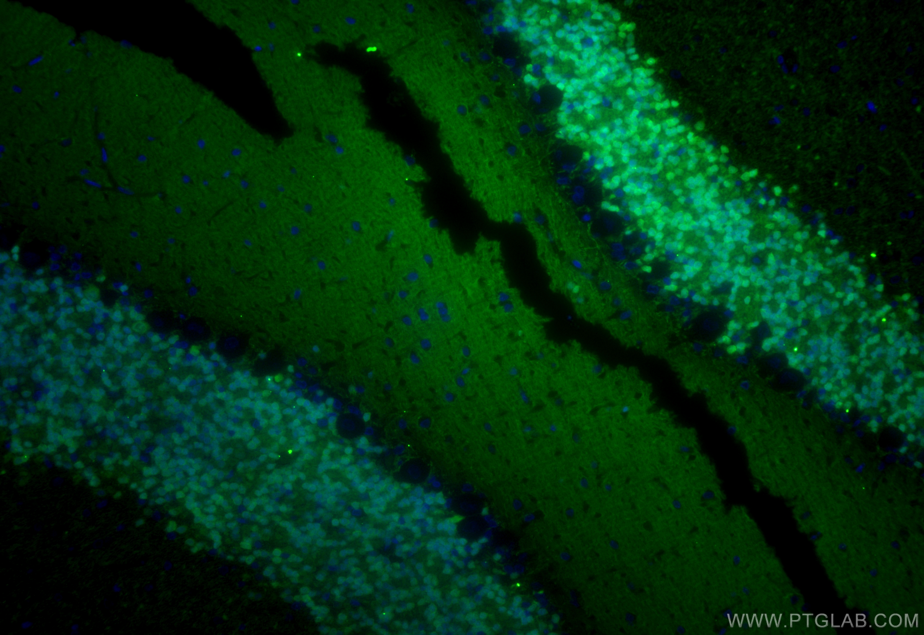 Immunofluorescence (IF) / fluorescent staining of rat cerebellum tissue using Calretinin Monoclonal antibody (66496-1-Ig)