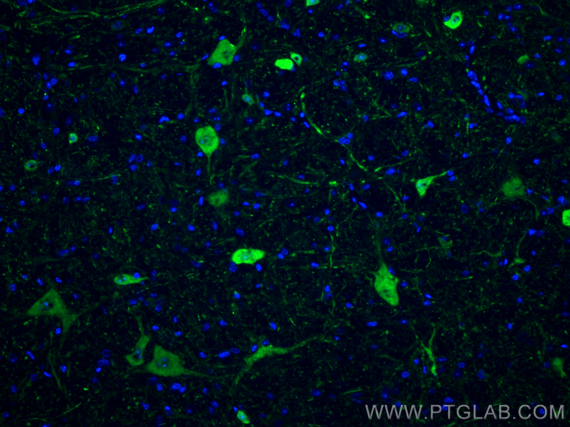 Immunofluorescence (IF) / fluorescent staining of mouse cerebellum tissue using Calretinin Monoclonal antibody (66496-1-Ig)