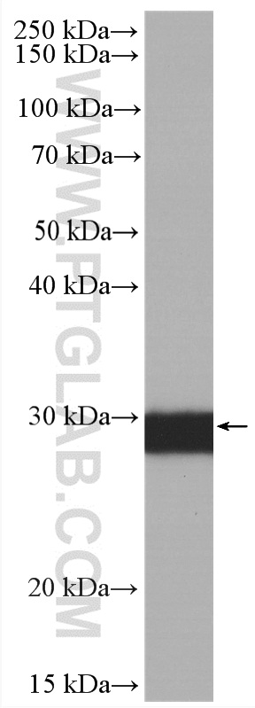 Western Blot (WB) analysis of mouse brain tissue using HRP-conjugated Calretinin Monoclonal antibody (HRP-66496)