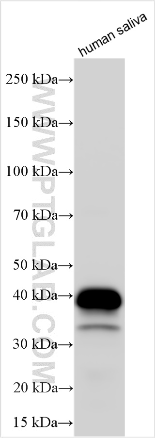 Western Blot (WB) analysis of various lysates using Carbonic Anhydrase 6/CA6 Polyclonal antibody (32740-1-AP)