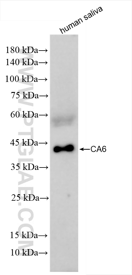 Western Blot (WB) analysis of various lysates using Carbonic Anhydrase 6/CA6 Recombinant antibody (85940-3-RR)