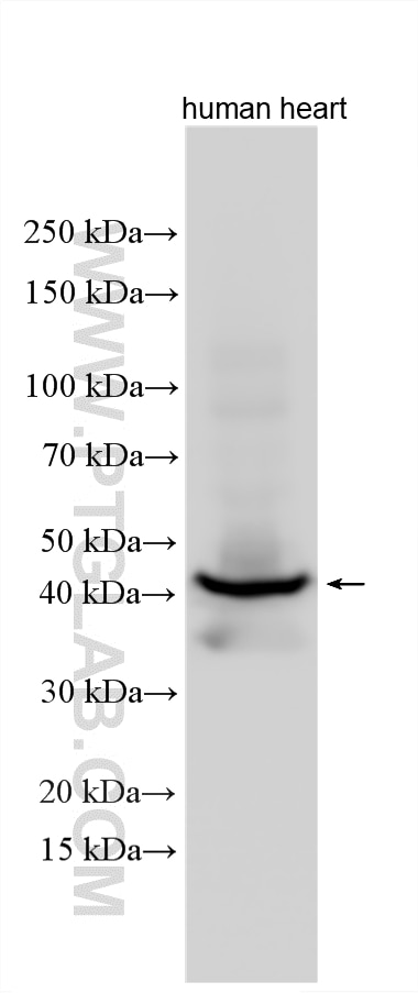 Western Blot (WB) analysis of various lysates using Cardiac Troponin T Polyclonal antibody (26592-1-AP)