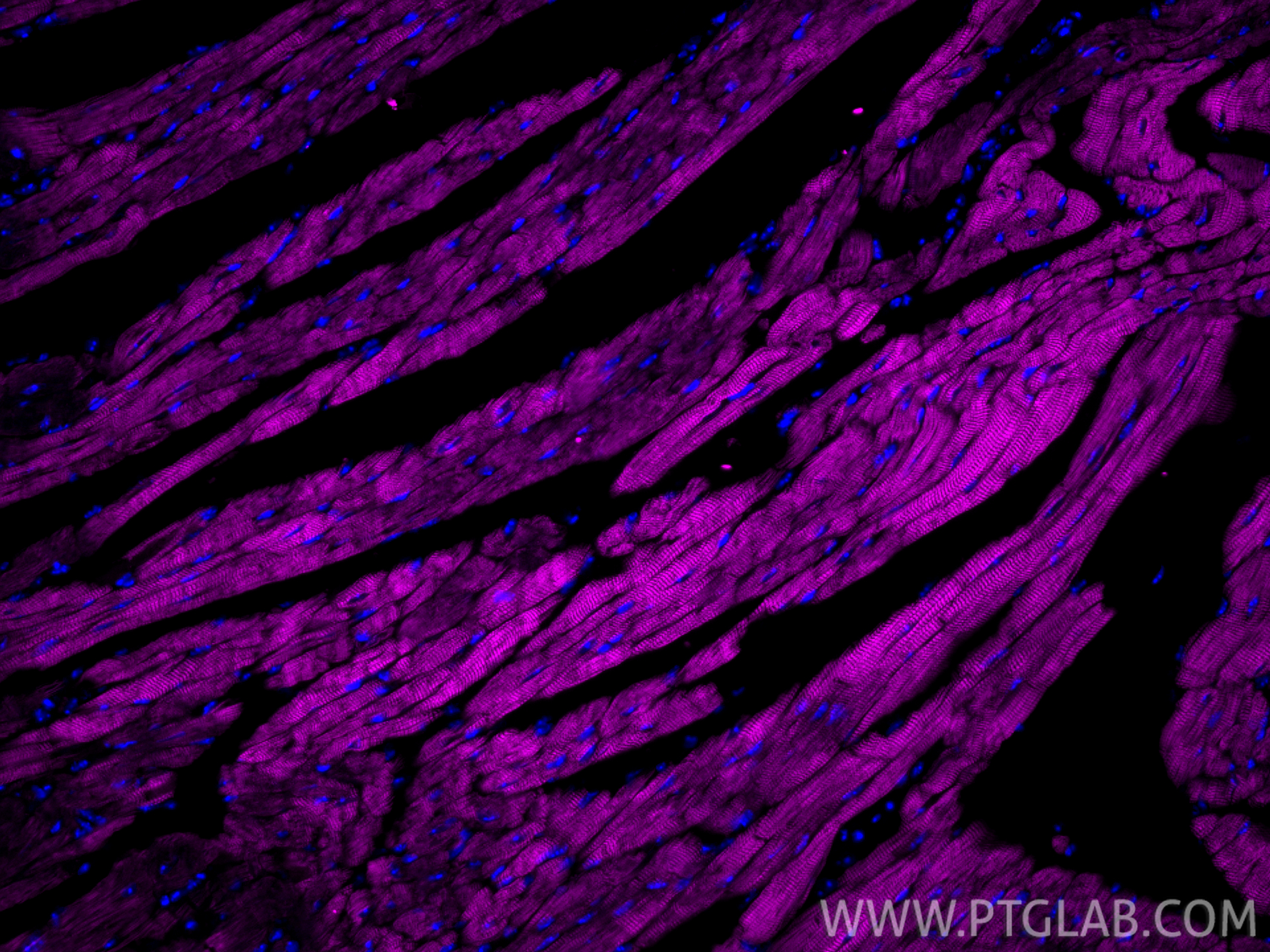 Immunofluorescence (IF) / fluorescent staining of mouse heart tissue using CoraLite® Plus 647-conjugated Cardiac Troponin T M (CL647-68300)