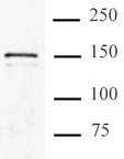 Cas9 antibody (mAb) tested by Immunoprecipitation. 5 ug of Cas9 antibody (mAb) was used to immunoprecipitate Cas9 from 100 ug of whole cell extracts after 72 hours of transient transfection of HEK293 cells with FLAG-Tagged Cas9. The immunoprecipitated protein was detected by Western blotting using Cas9 antibody (mAb) at a 0.5 ug/mL dilution.