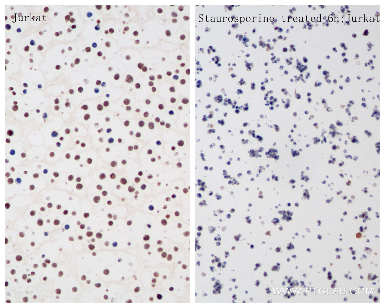 Immunohistochemistry (IHC) staining of Jurkat cells using Caspase 10 Recombinant antibody (85196-3-RR)