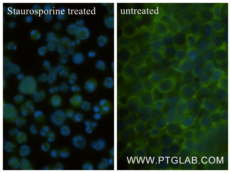Immunofluorescence (IF) / fluorescent staining of Jurkat cells using Caspase 6 Recombinant antibody (85201-2-RR)