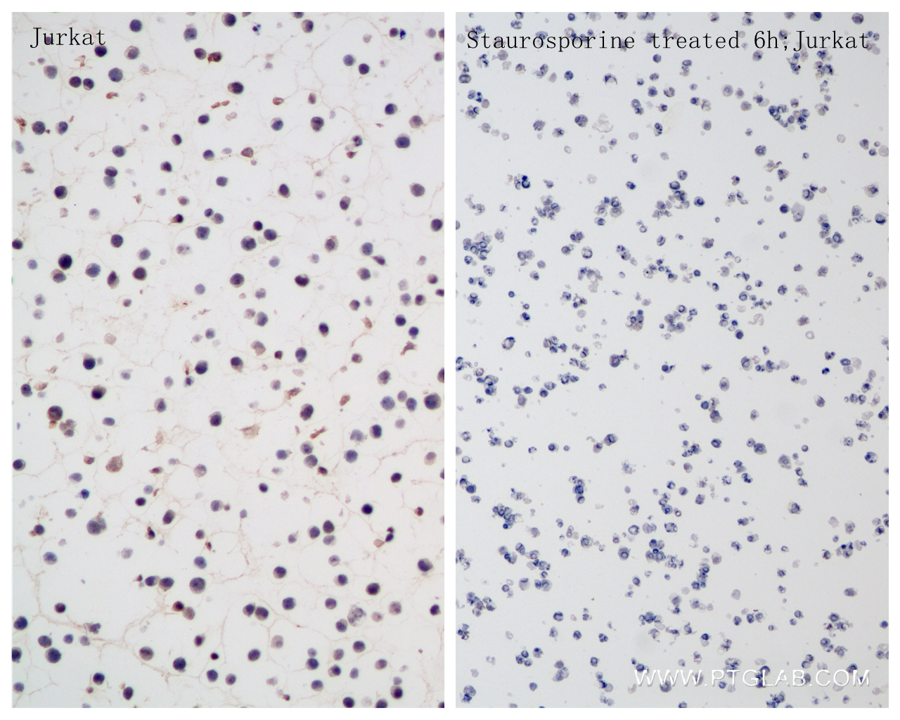 Immunohistochemistry (IHC) staining of Jurkat cells using Caspase 6 Recombinant antibody (85201-2-RR)