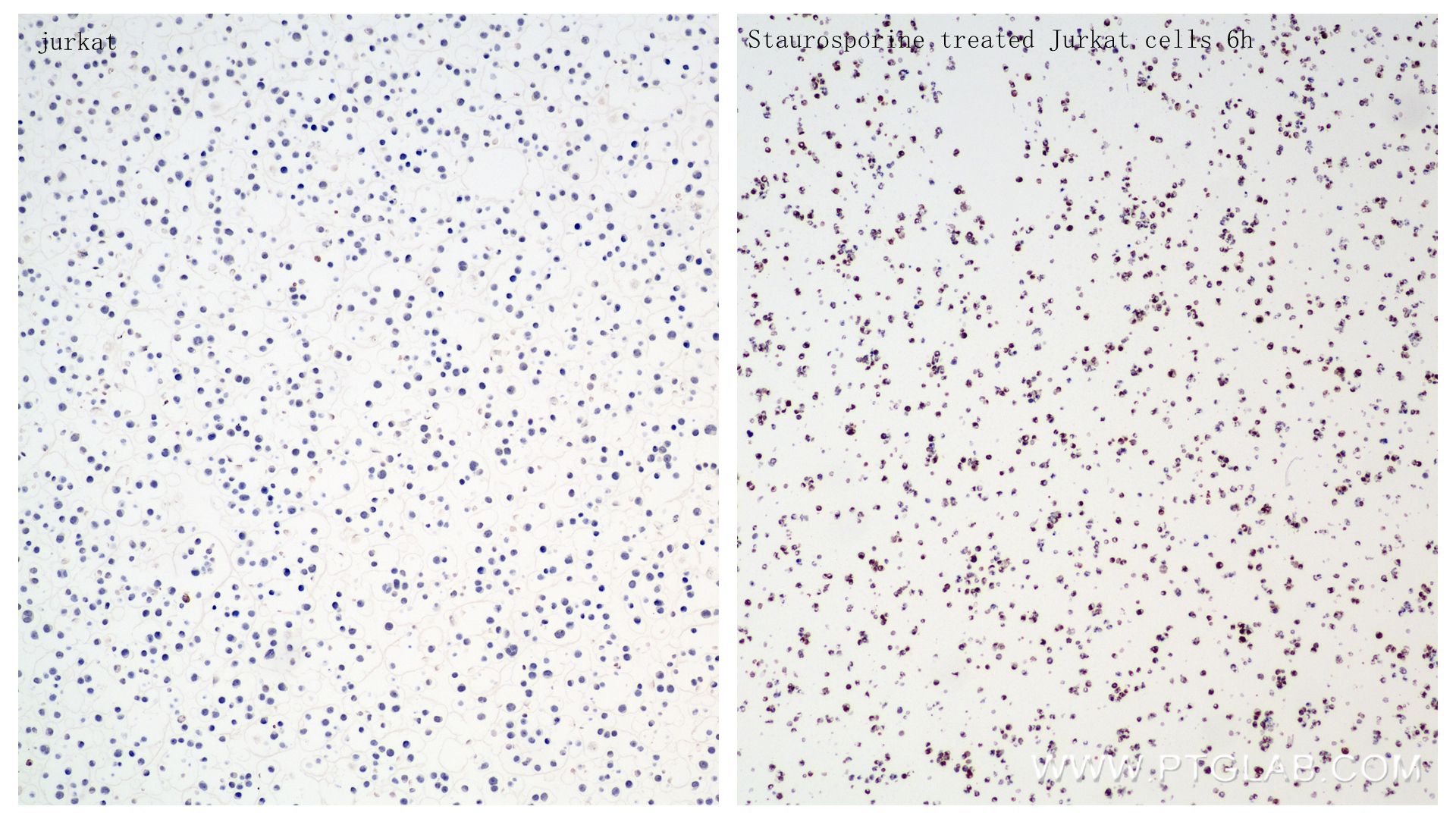 Immunohistochemistry (IHC) staining of Jurkat cells using Cleaved Caspase 8/P18 Recombinant antibody (85171-3-RR)