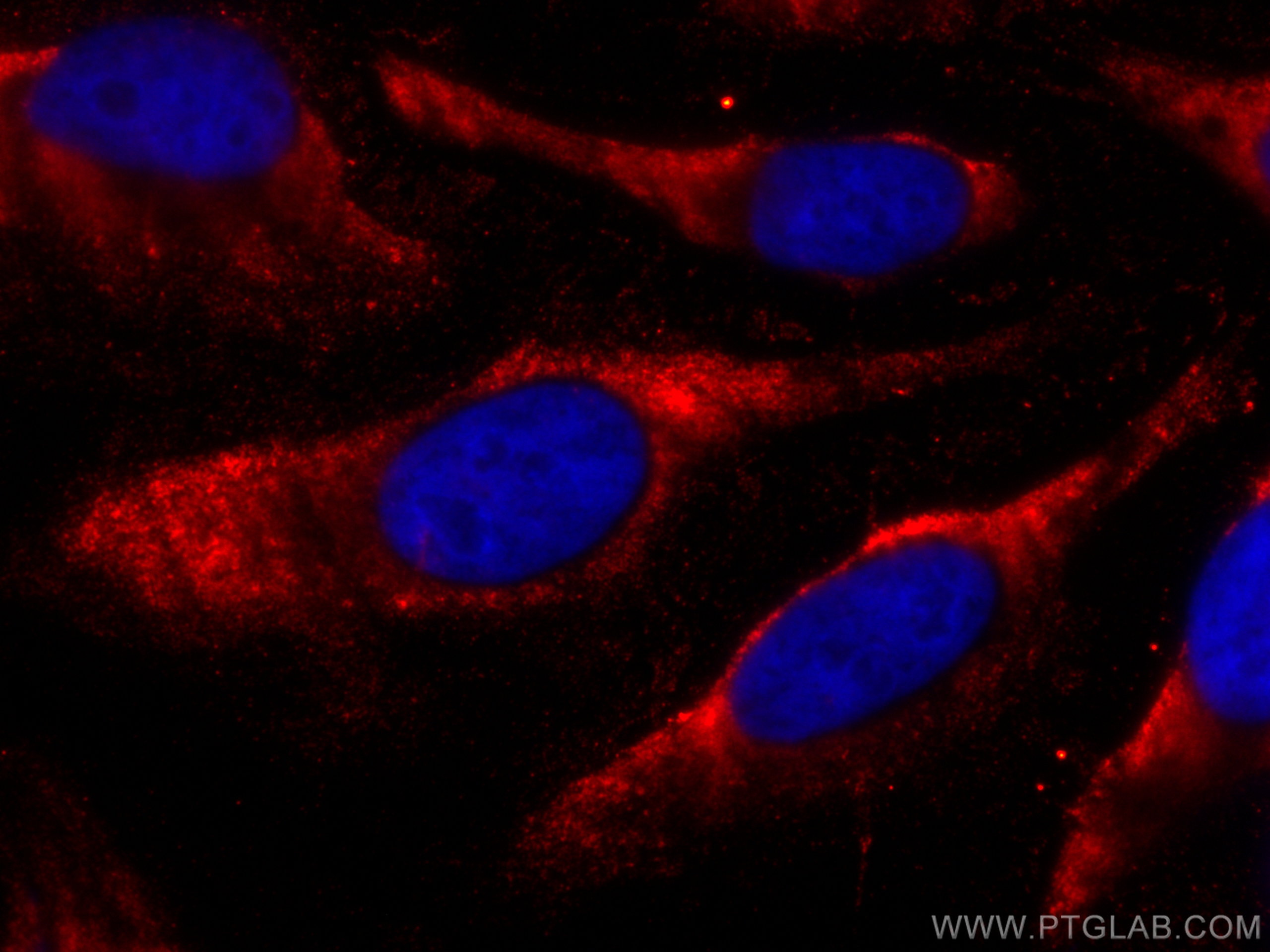 Immunofluorescence (IF) / fluorescent staining of HeLa cells using CoraLite®594-conjugated Caspase 8/p43/p18 Monoclon (CL594-66093)