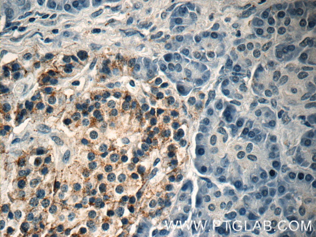 Immunohistochemistry (IHC) staining of human pancreas tissue using Caspase 9/p35/p10 Monoclonal antibody (66169-1-Ig)