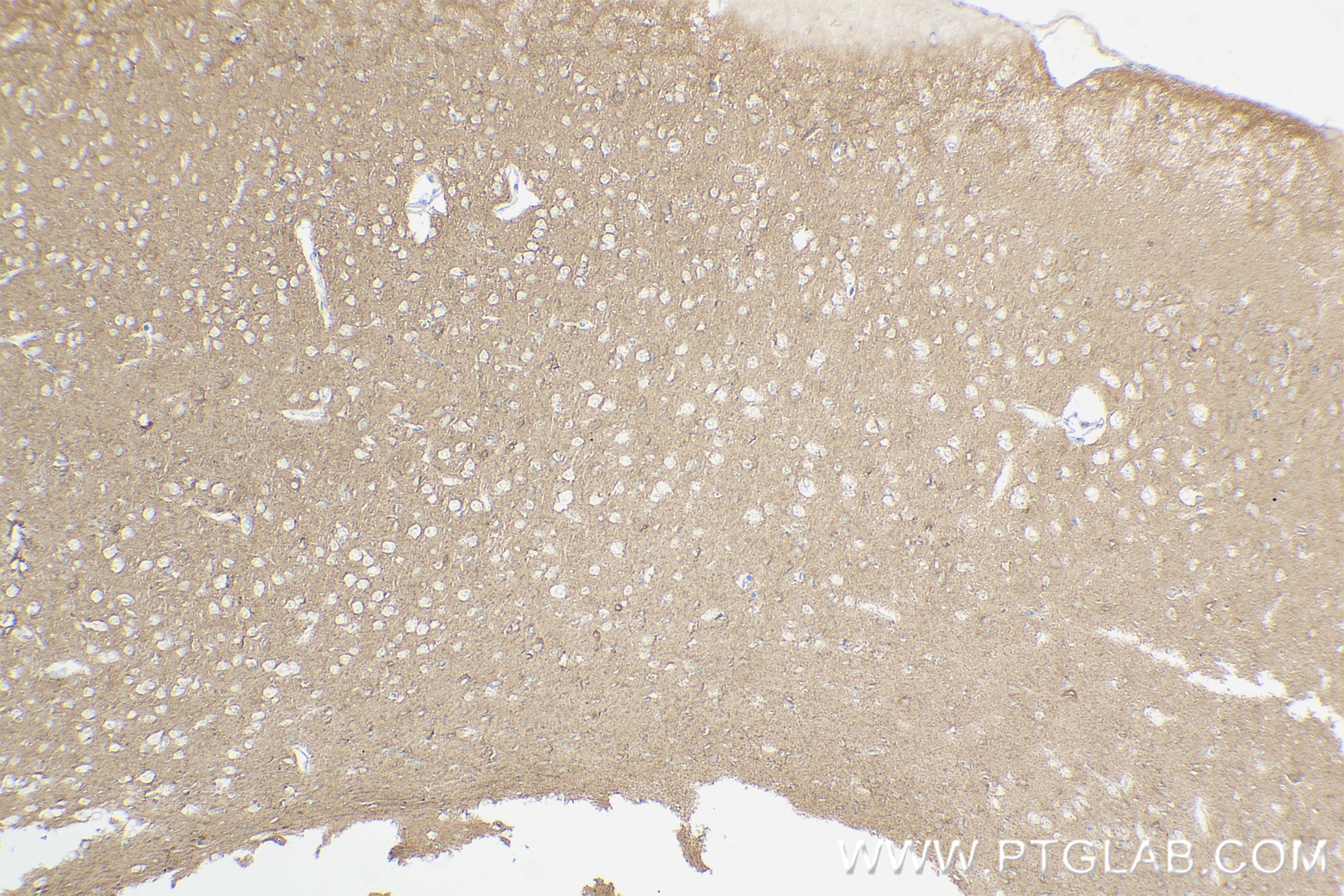 Immunohistochemistry (IHC) staining of mouse brain tissue using Caspr2/CNTNAP2 Recombinant antibody (85116-4-RR)
