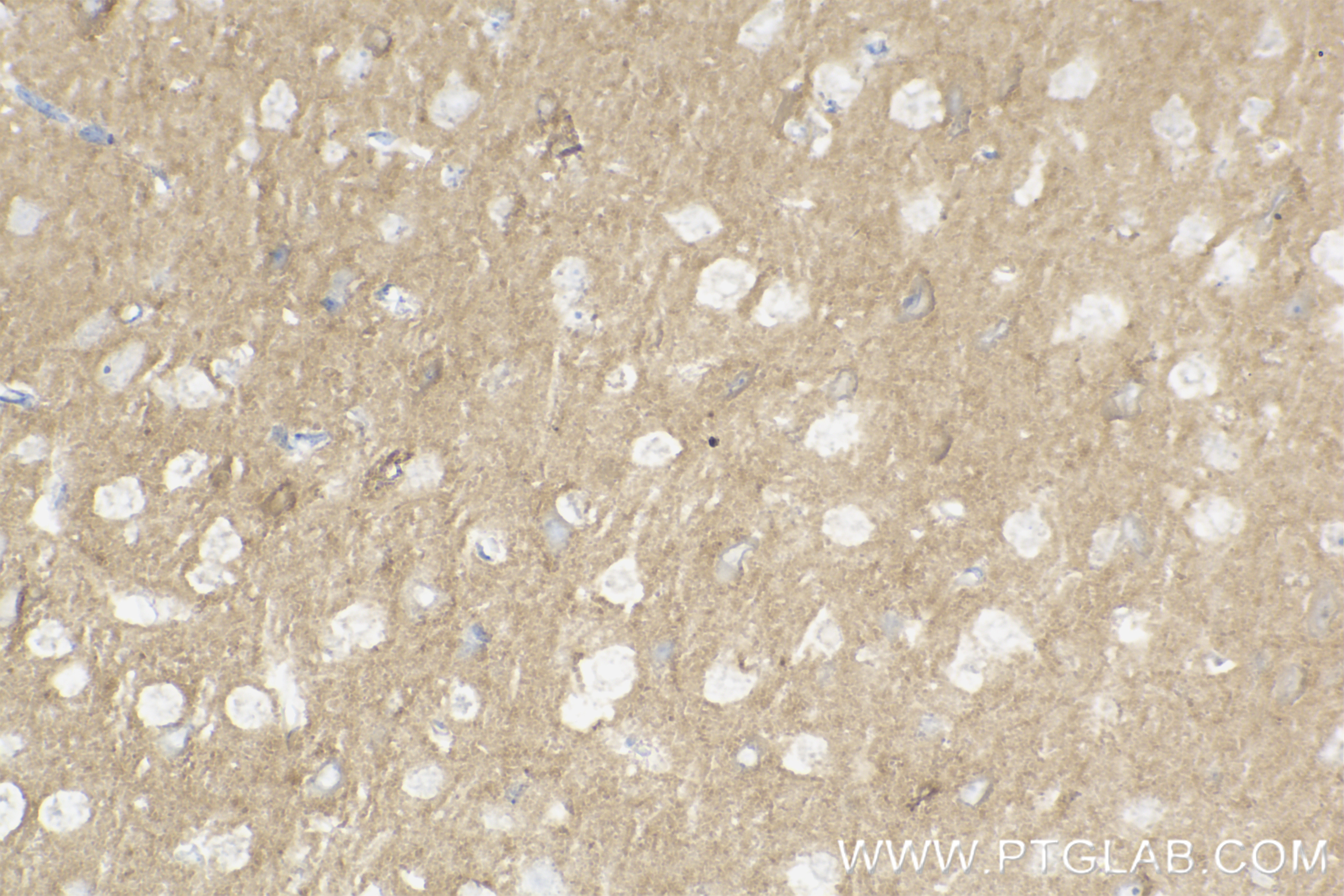 Immunohistochemistry (IHC) staining of mouse brain tissue using Caspr2/CNTNAP2 Recombinant antibody (85116-4-RR)