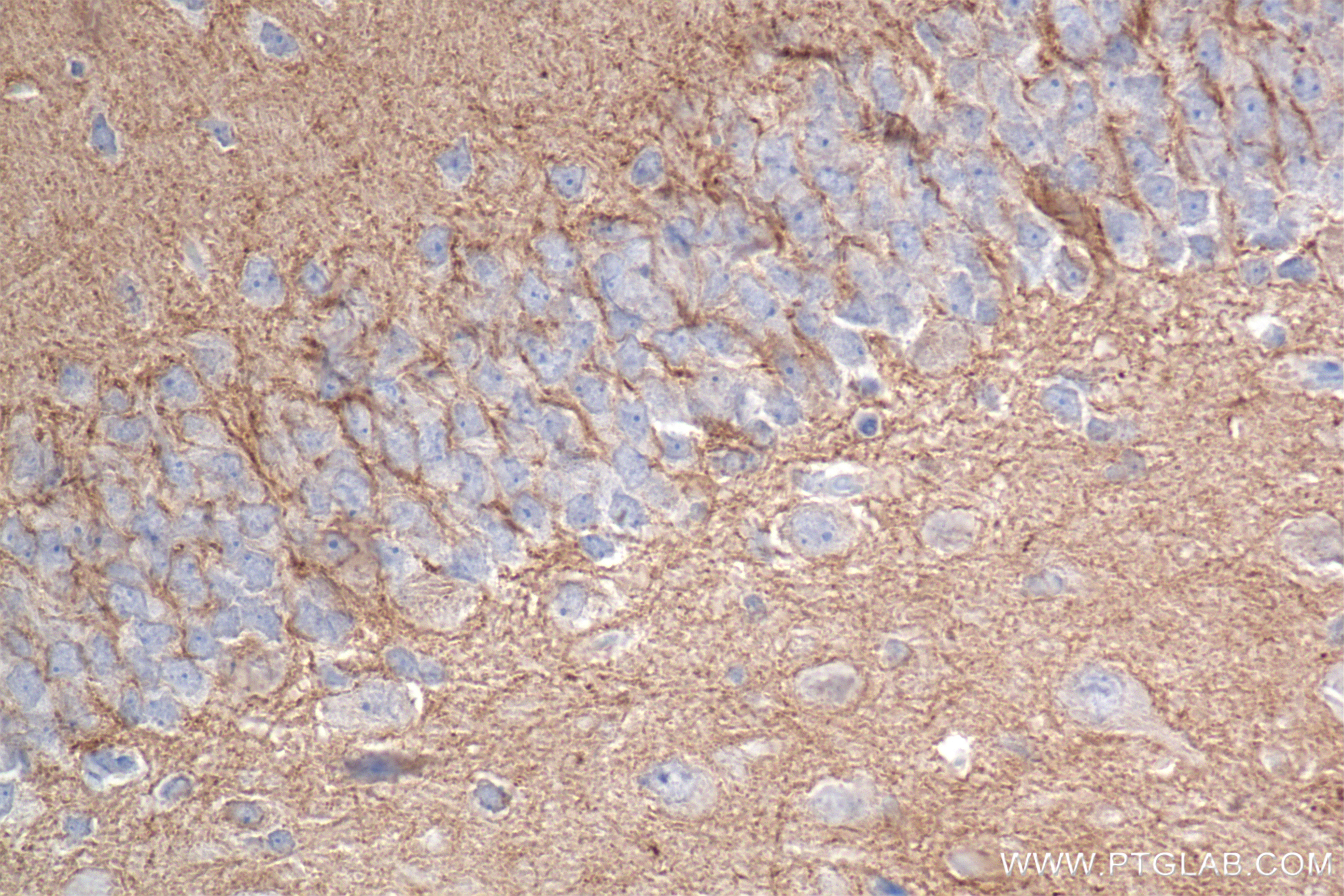 Immunohistochemistry (IHC) staining of rat brain tissue using Caspr2/CNTNAP2 Recombinant antibody (85116-4-RR)