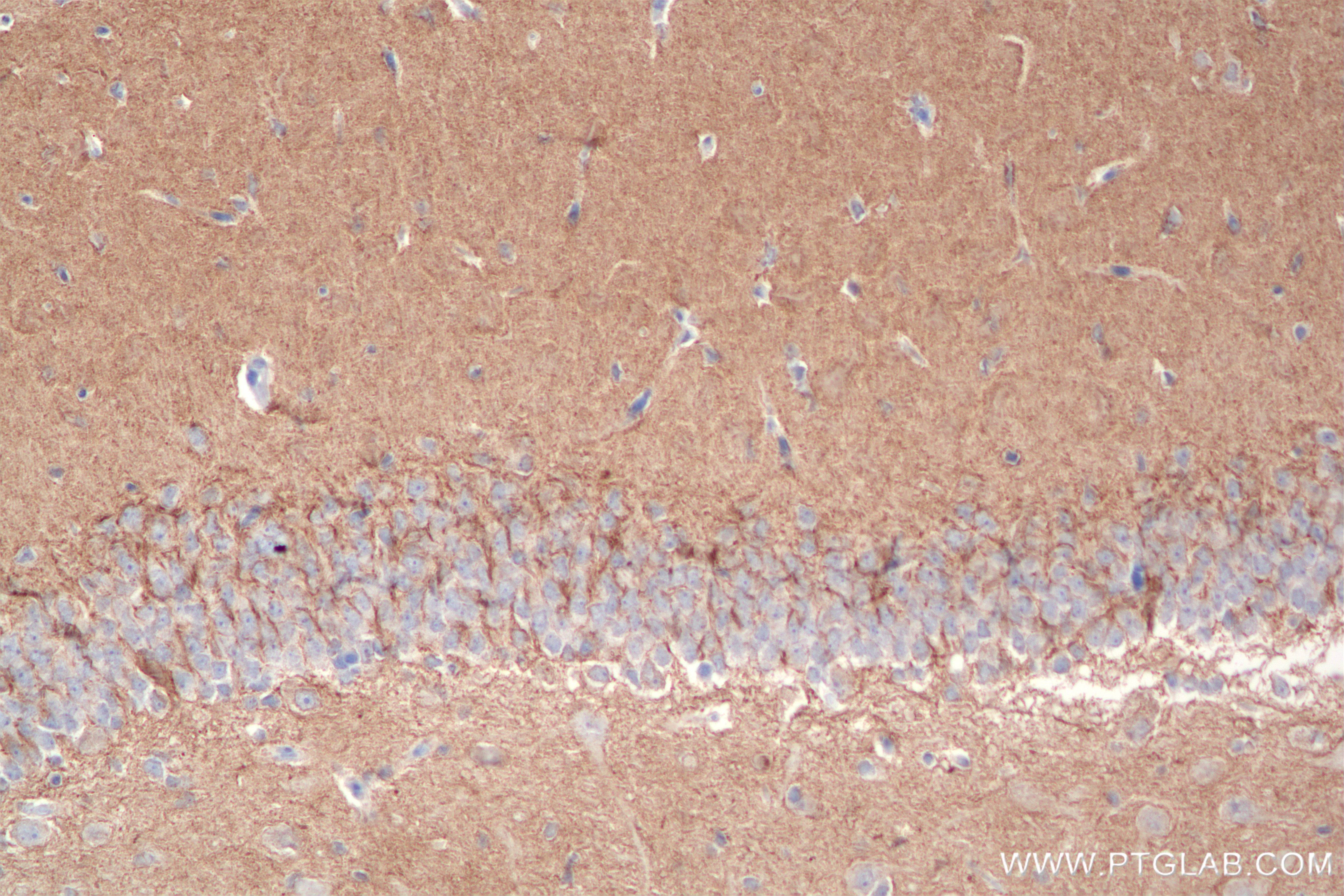 Immunohistochemistry (IHC) staining of rat brain tissue using Caspr2/CNTNAP2 Recombinant antibody (85116-4-RR)