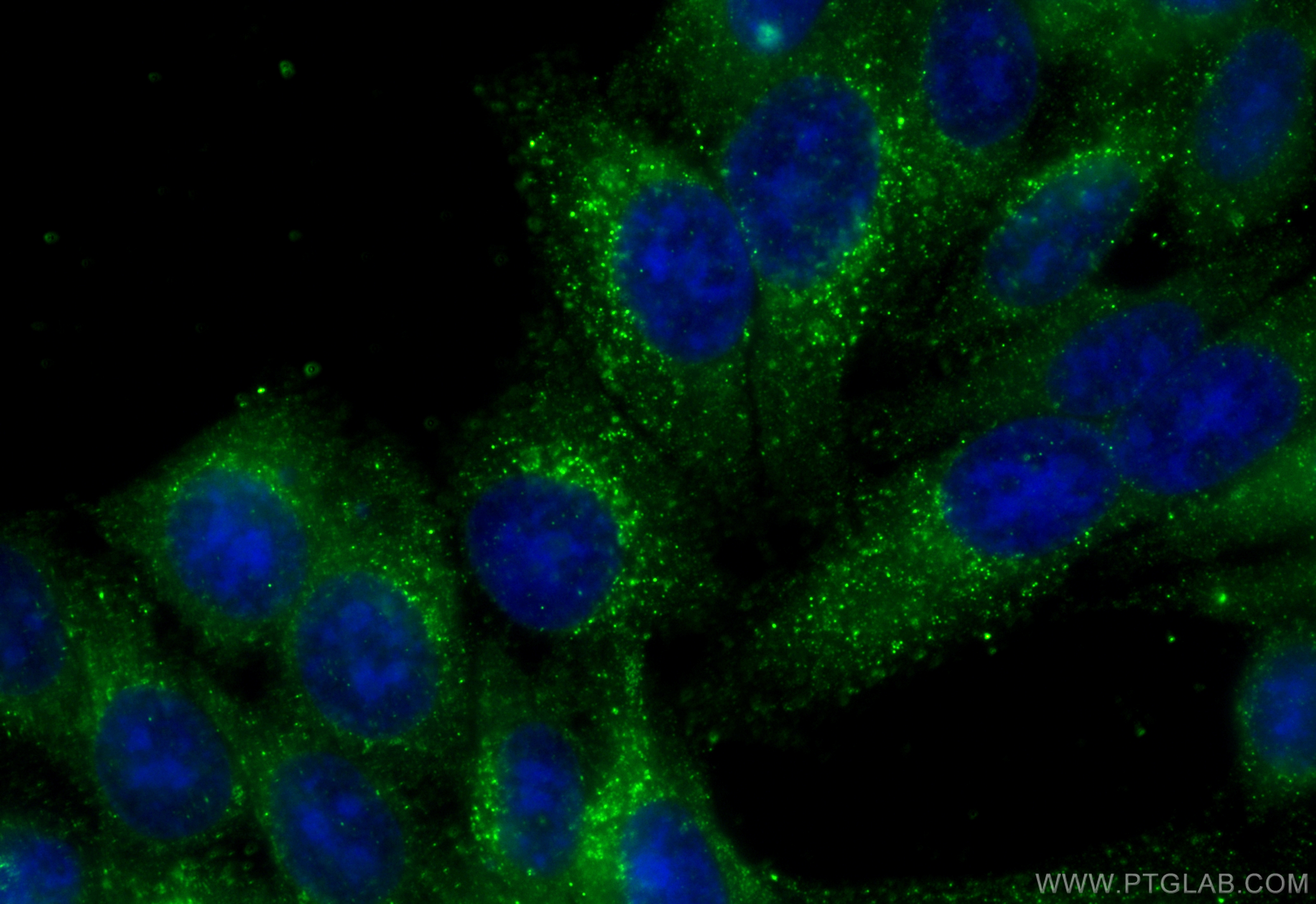 Immunofluorescence (IF) / fluorescent staining of HepG2 cells using Catalase Monoclonal antibody (66765-1-Ig)