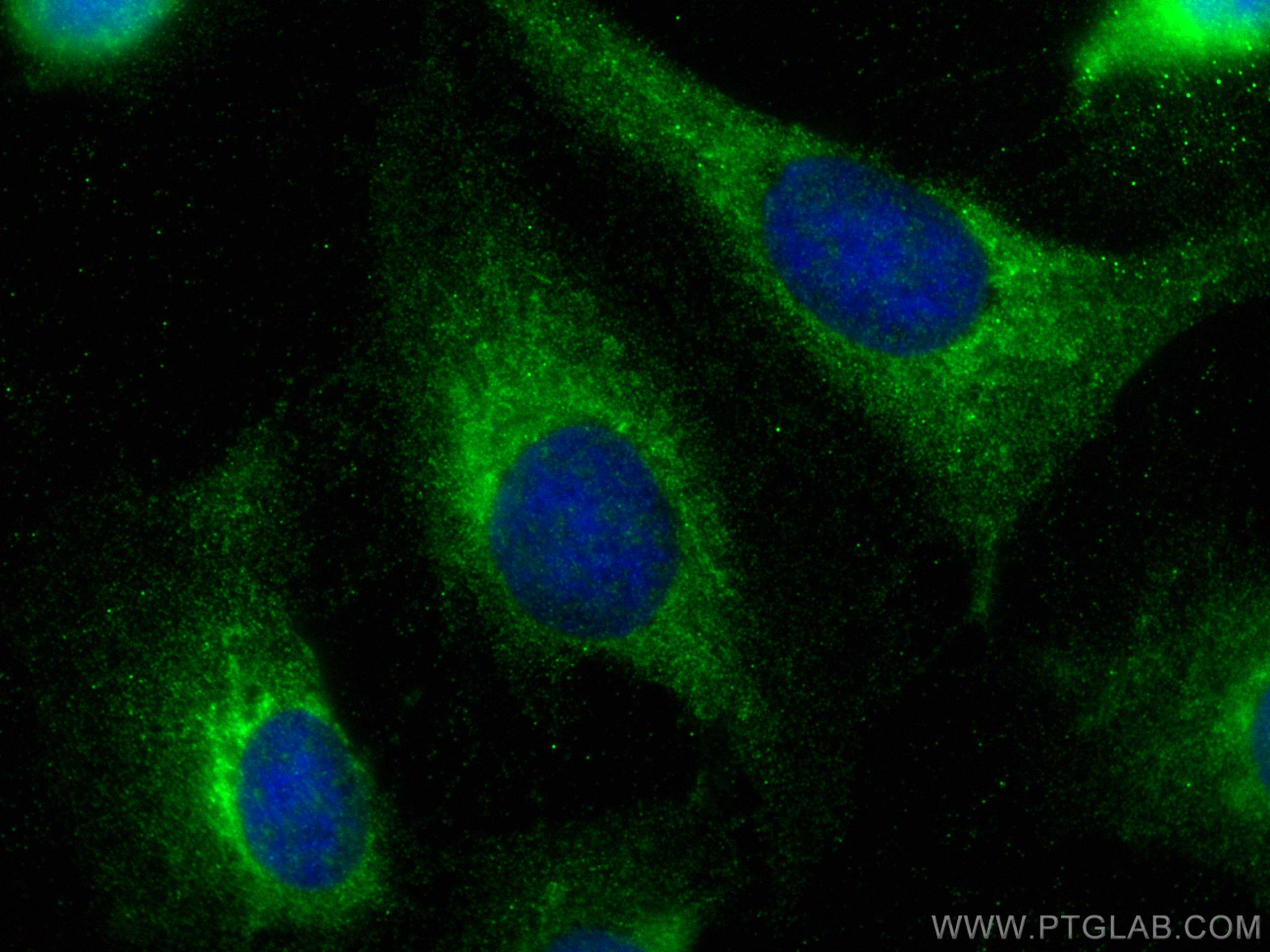 Immunofluorescence (IF) / fluorescent staining of U2OS cells using Cathepsin C Polyclonal antibody (30790-1-AP)