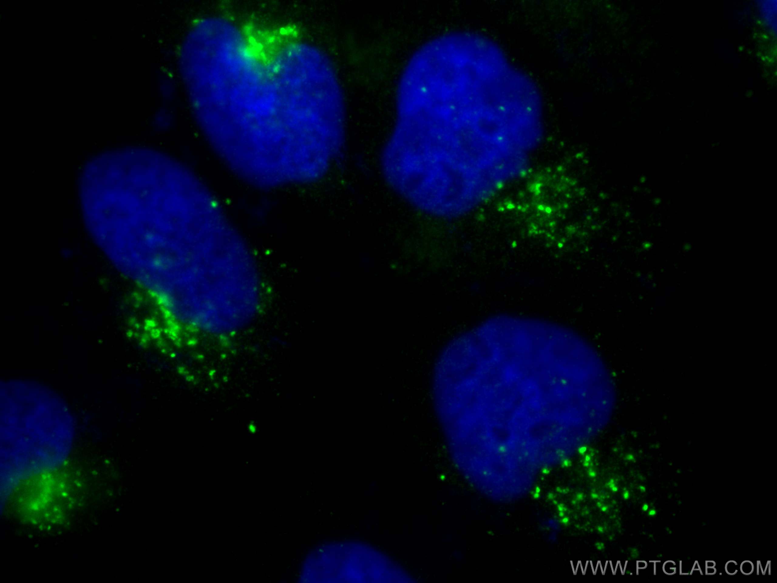 Immunofluorescence (IF) / fluorescent staining of A431 cells using Cathepsin D Polyclonal antibody (31516-1-AP)