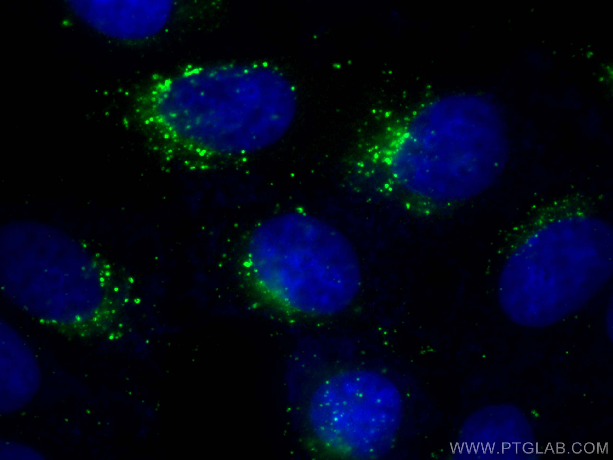 Immunofluorescence (IF) / fluorescent staining of MCF-7 cells using Cathepsin D Polyclonal antibody (31516-1-AP)