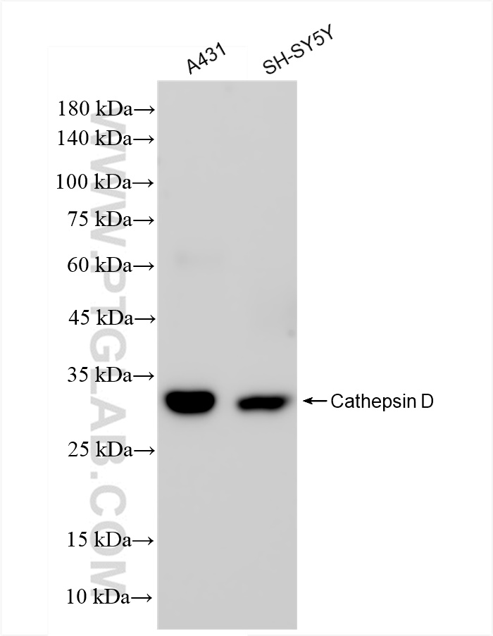 Western Blot (WB) analysis of various lysates using Cathepsin D Recombinant antibody (83743-2-RR)