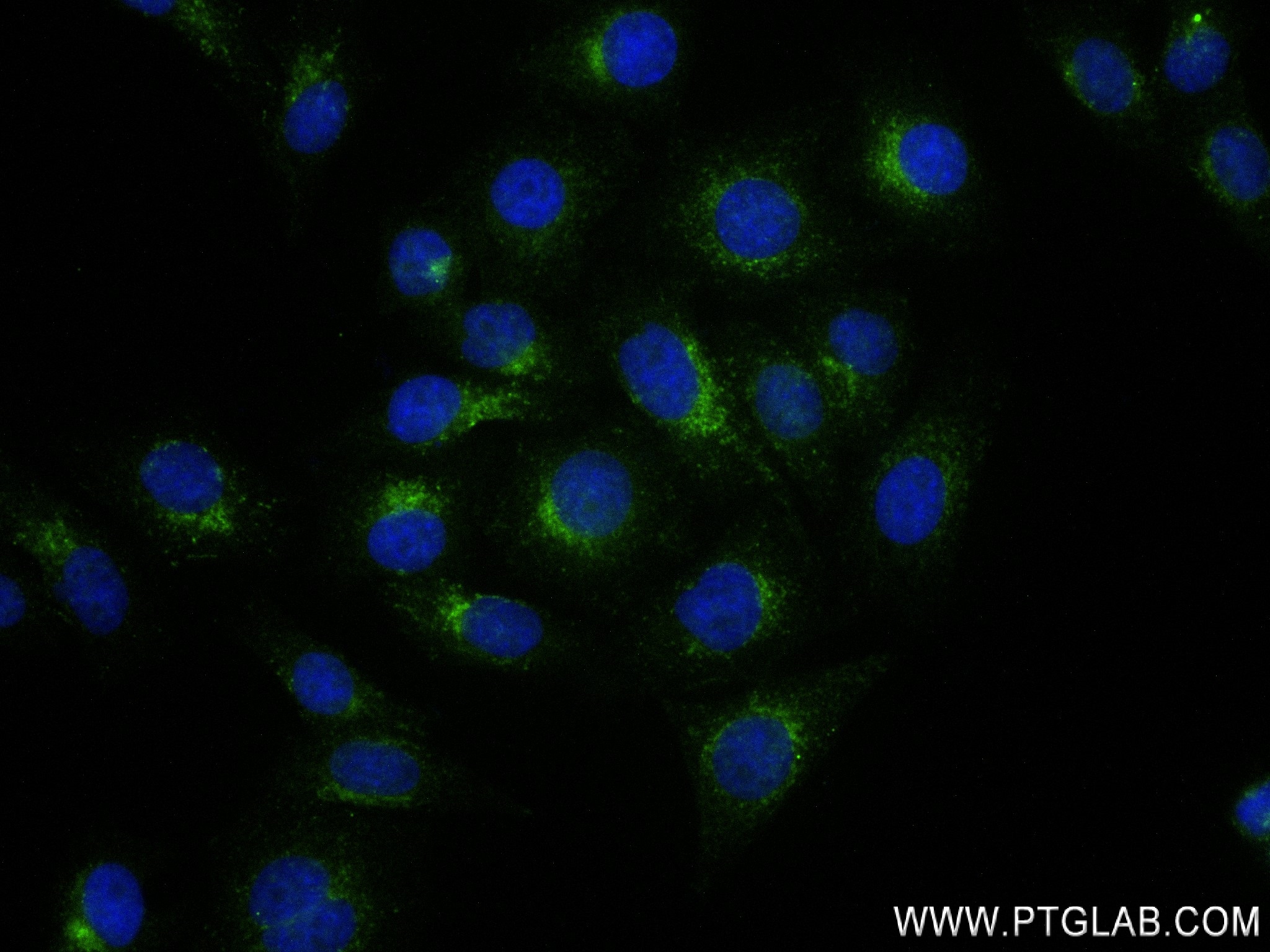 Immunofluorescence (IF) / fluorescent staining of HepG2 cells using Cathepsin D Recombinant antibody (83743-5-RR)