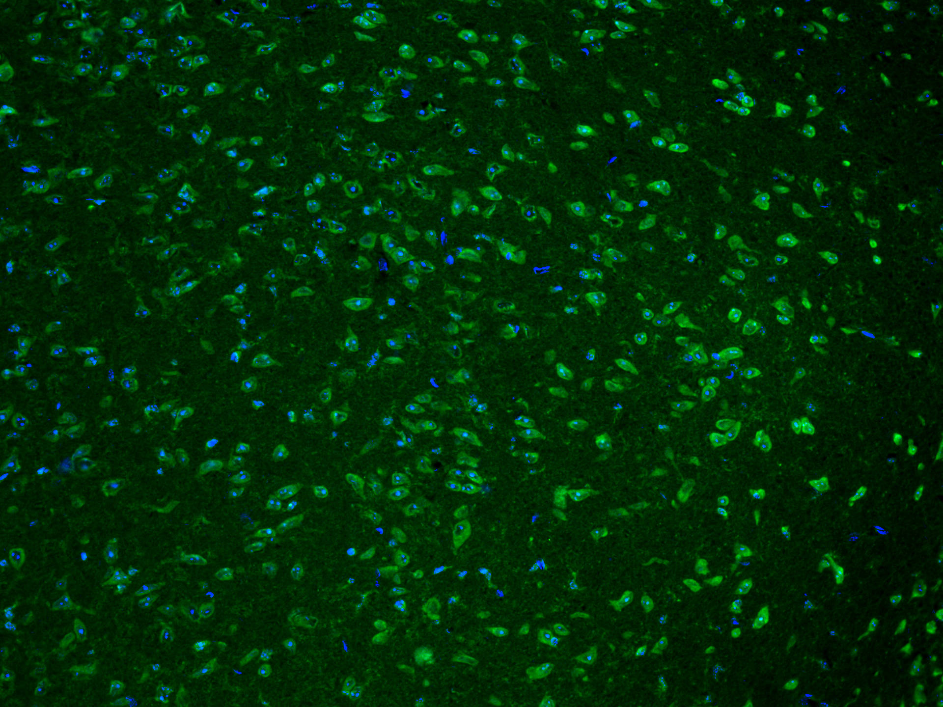 Immunofluorescence (IF) / fluorescent staining of mouse brain tissue using CoraLite® Plus 488-conjugated Cathepsin K Polyclon (CL488-11239)