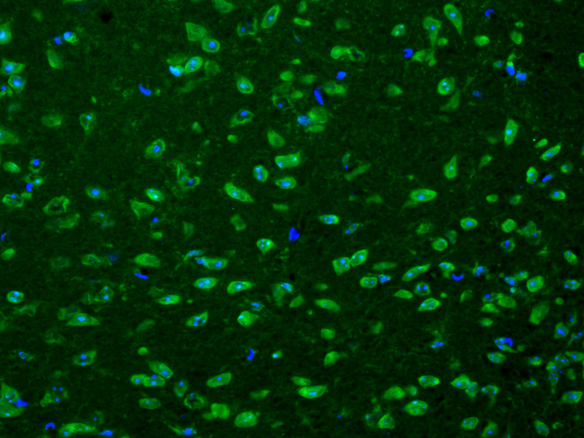 Immunofluorescence (IF) / fluorescent staining of mouse brain tissue using CoraLite® Plus 488-conjugated Cathepsin K Polyclon (CL488-11239)