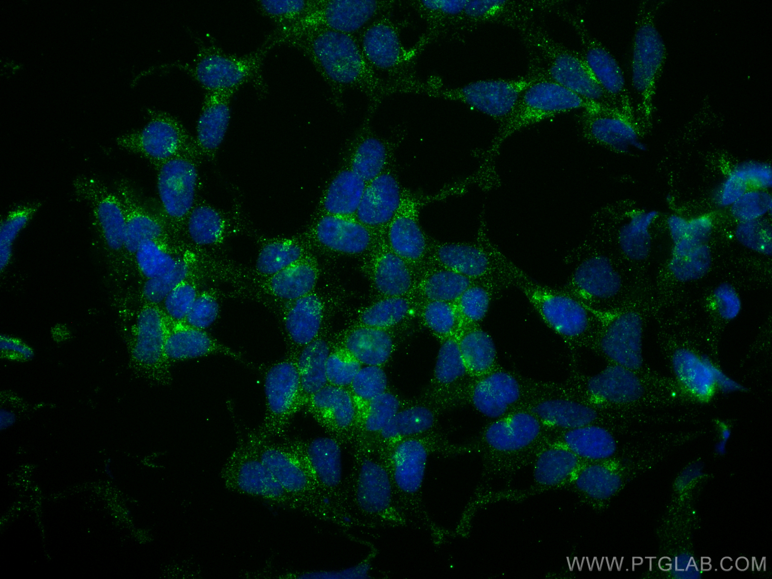 Immunofluorescence (IF) / fluorescent staining of HEK-293 cells using Cathepsin L Monoclonal antibody (66914-1-Ig)