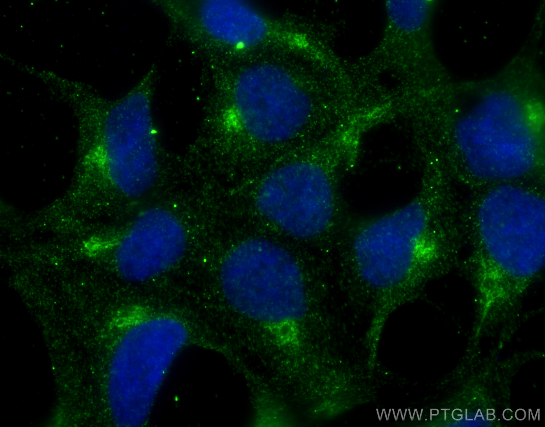 Immunofluorescence (IF) / fluorescent staining of HEK-293 cells using Cathepsin L Monoclonal antibody (66914-1-Ig)