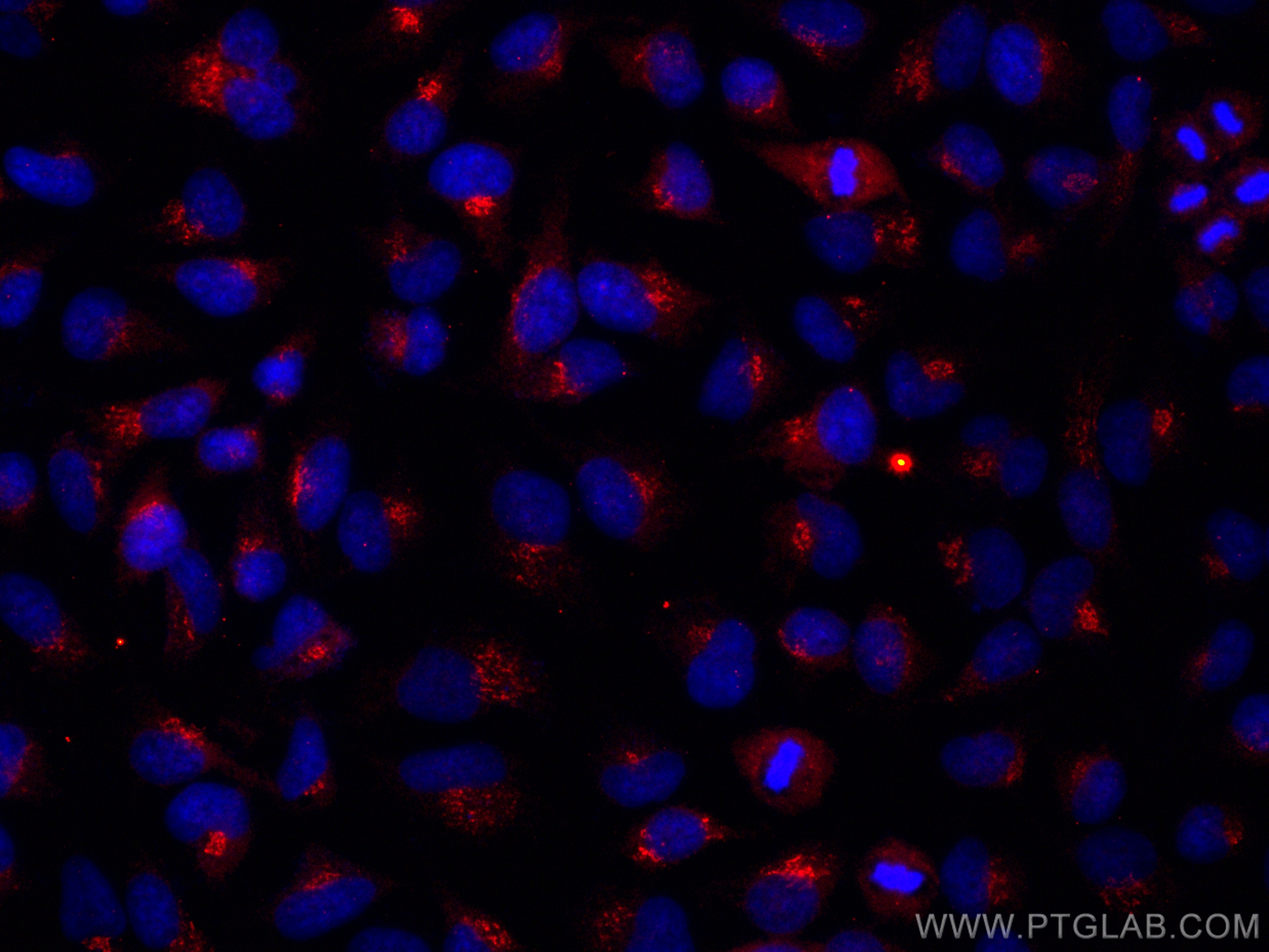 Immunofluorescence (IF) / fluorescent staining of HeLa cells using CoraLite®594-conjugated Cathepsin L Monoclonal ant (CL594-66914)