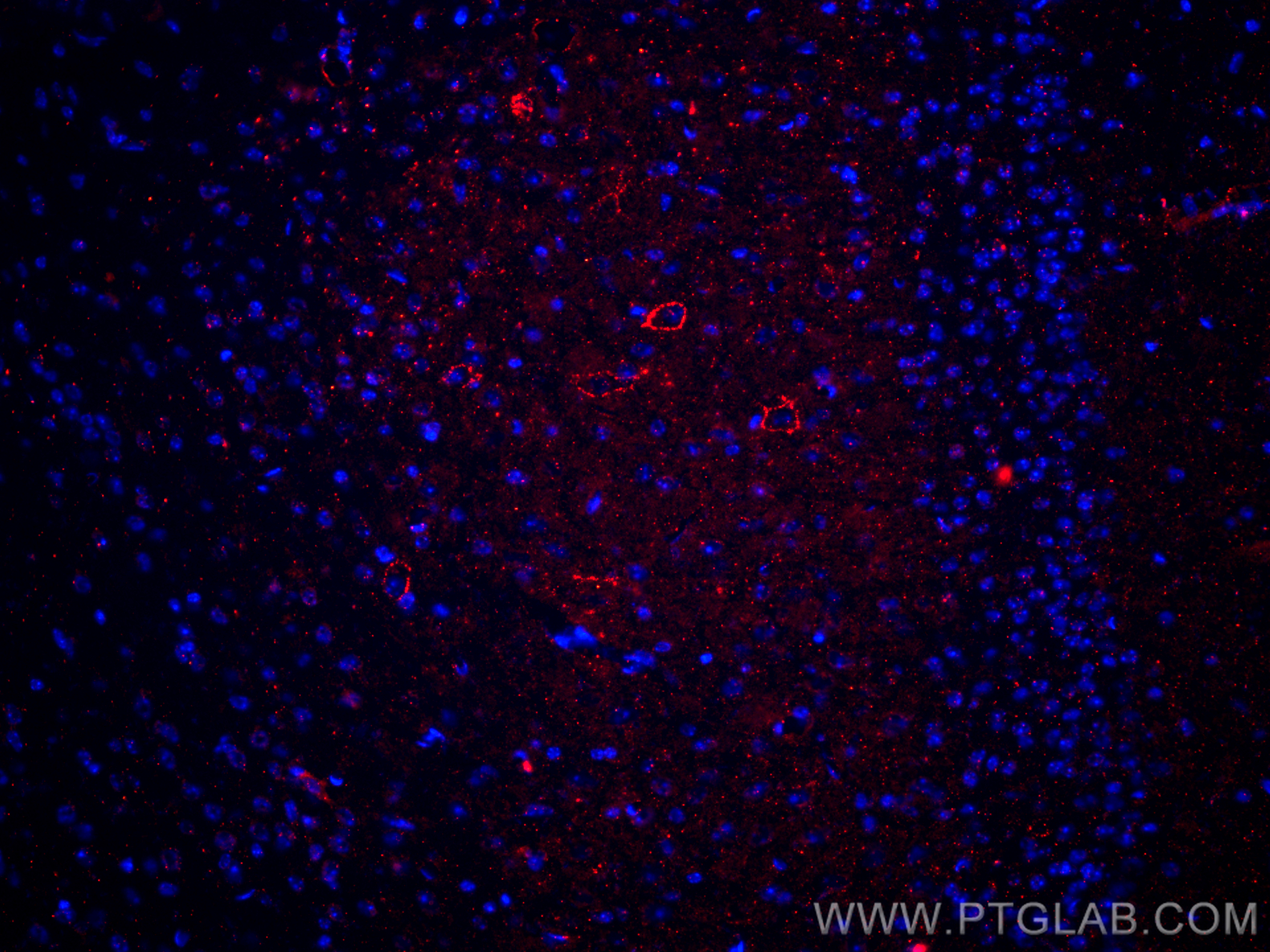 Immunofluorescence (IF) / fluorescent staining of mouse brain tissue using CD31 Polyclonal antibody (28083-1-AP)