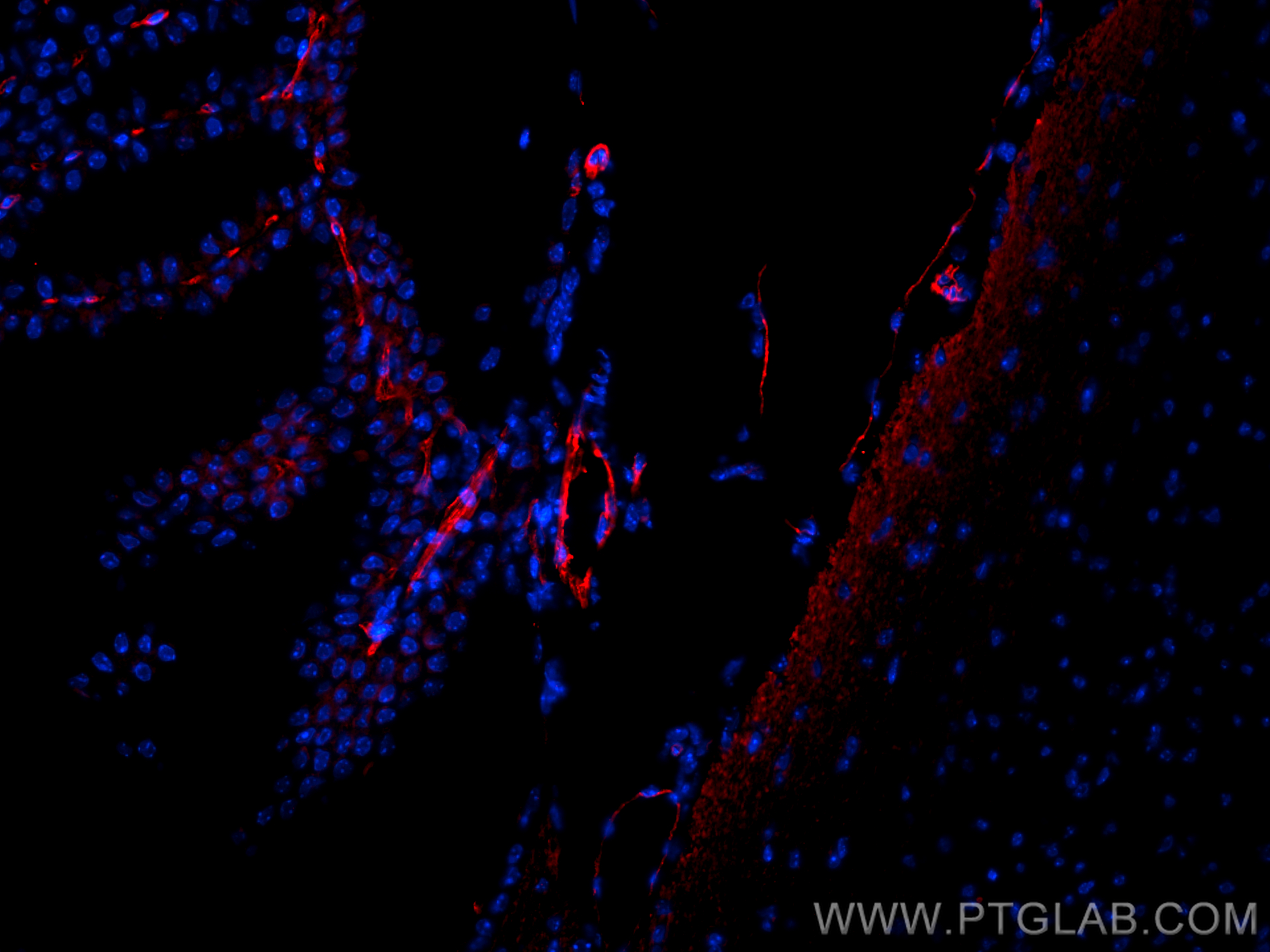 Immunofluorescence (IF) / fluorescent staining of mouse brain tissue using CD31 Polyclonal antibody (28083-1-AP)