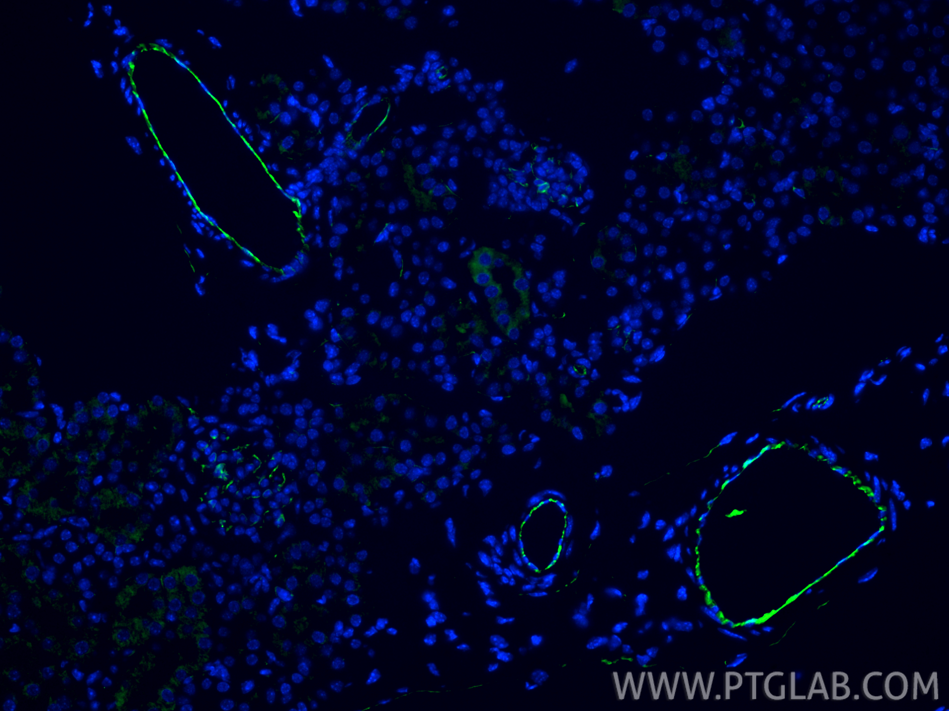 Immunofluorescence (IF) / fluorescent staining of mouse kidney tissue using CD31 Polyclonal antibody (28083-1-AP)