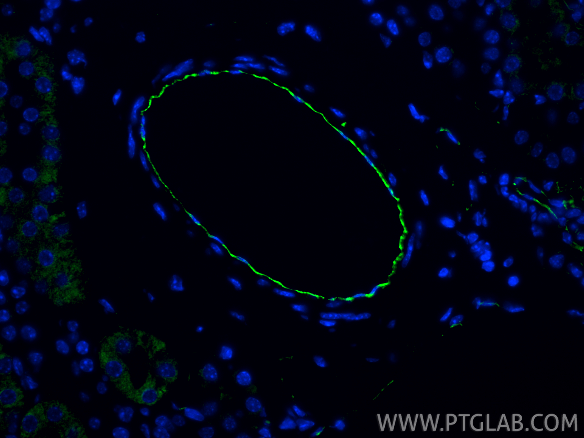 Immunofluorescence (IF) / fluorescent staining of mouse kidney tissue using CD31 Polyclonal antibody (28083-1-AP)