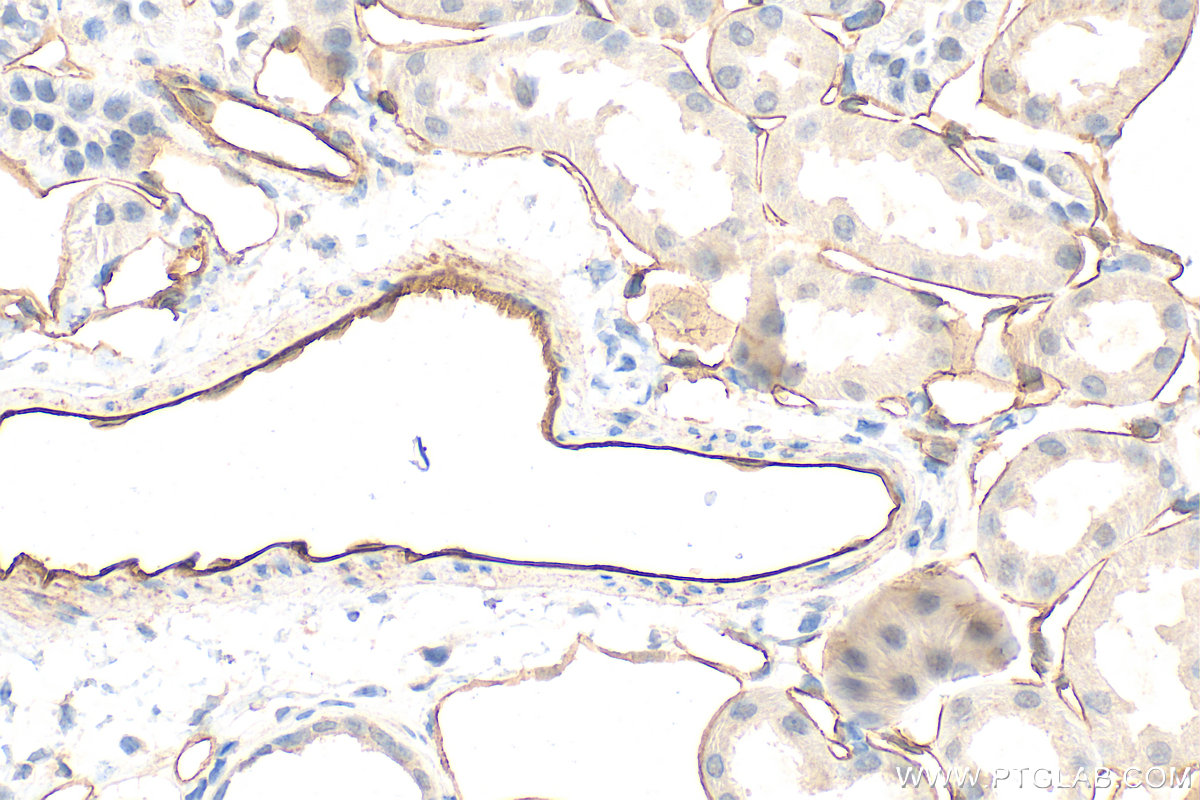 Immunohistochemistry (IHC) staining of mouse kidney tissue using CD31 Polyclonal antibody (28083-1-AP)