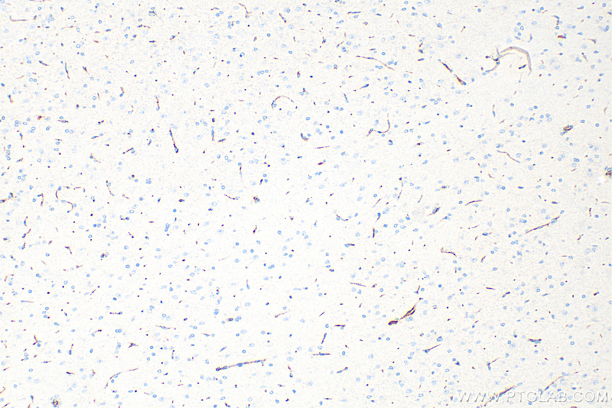 Immunohistochemistry (IHC) staining of rat brain tissue using CD31 Polyclonal antibody (28083-1-AP)
