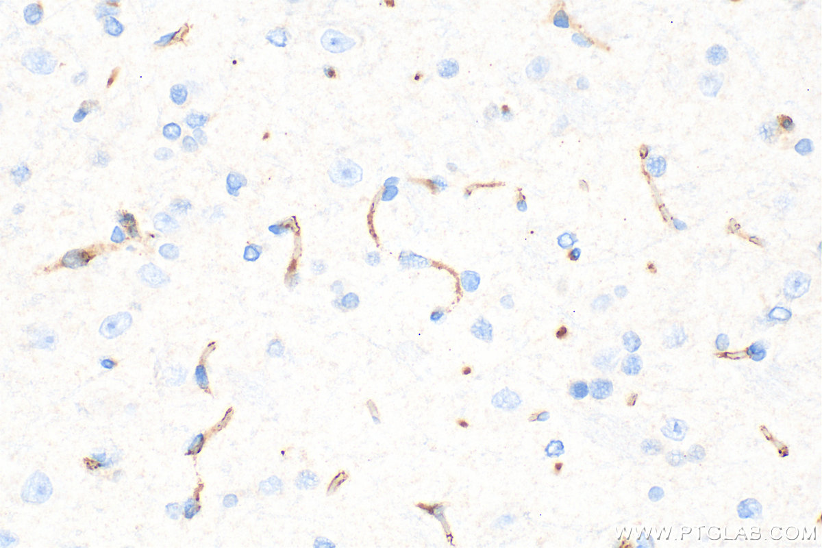 Immunohistochemistry (IHC) staining of rat brain tissue using CD31 Polyclonal antibody (28083-1-AP)