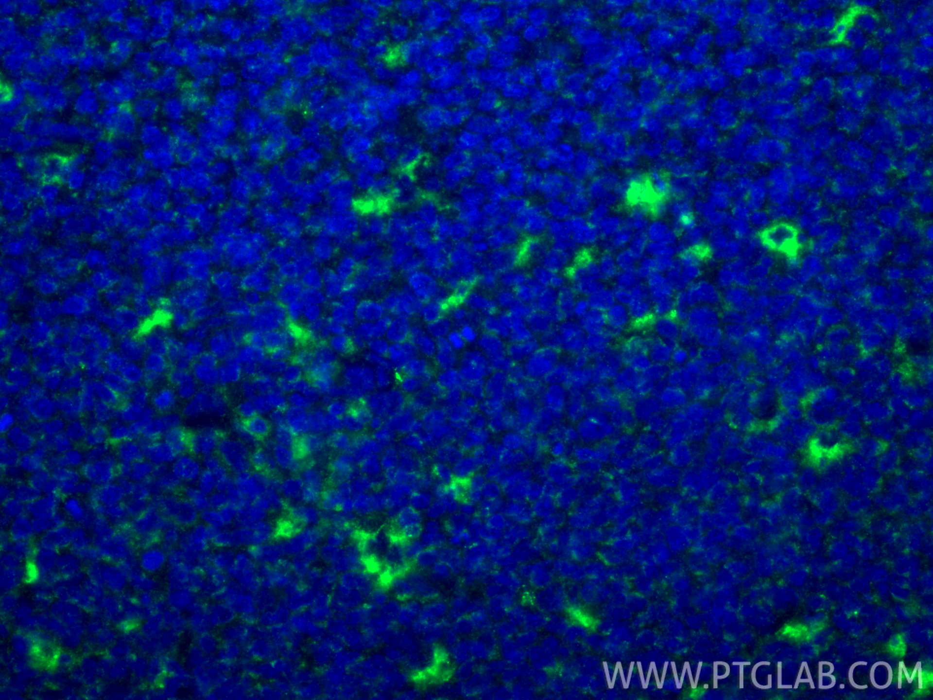 Immunofluorescence (IF) / fluorescent staining of human tonsillitis tissue using CD68 Polyclonal antibody (28058-1-AP)