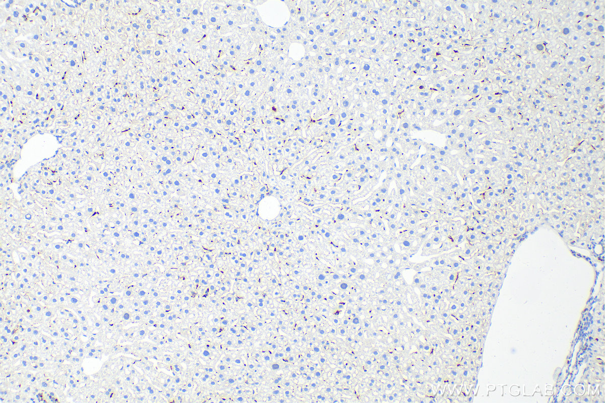 Immunohistochemistry (IHC) staining of mouse liver tissue using CD68 Polyclonal antibody (28058-1-AP)