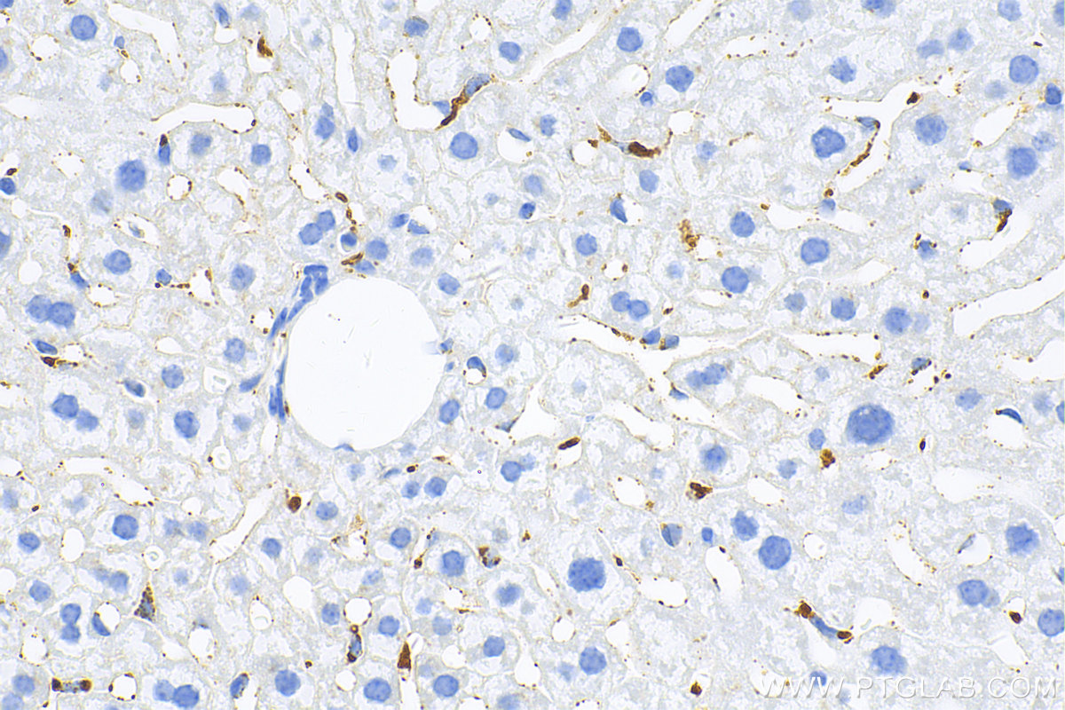 Immunohistochemistry (IHC) staining of mouse liver tissue using CD68 Polyclonal antibody (28058-1-AP)