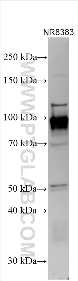 Western Blot (WB) analysis of various lysates using CD68 Polyclonal antibody (28058-1-AP)