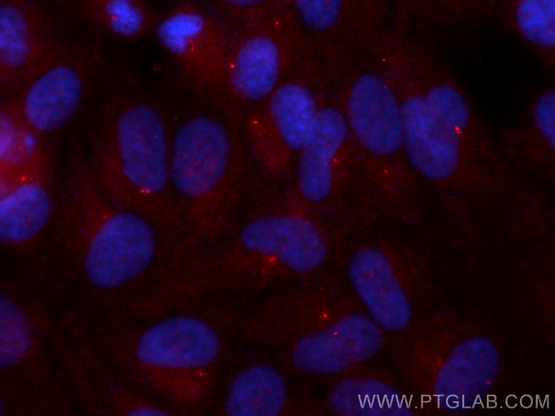 Immunofluorescence (IF) / fluorescent staining of hTERT-RPE1 cells using CoraLite®594-conjugated Centrin 1 Polyclonal antib (CL594-12794)