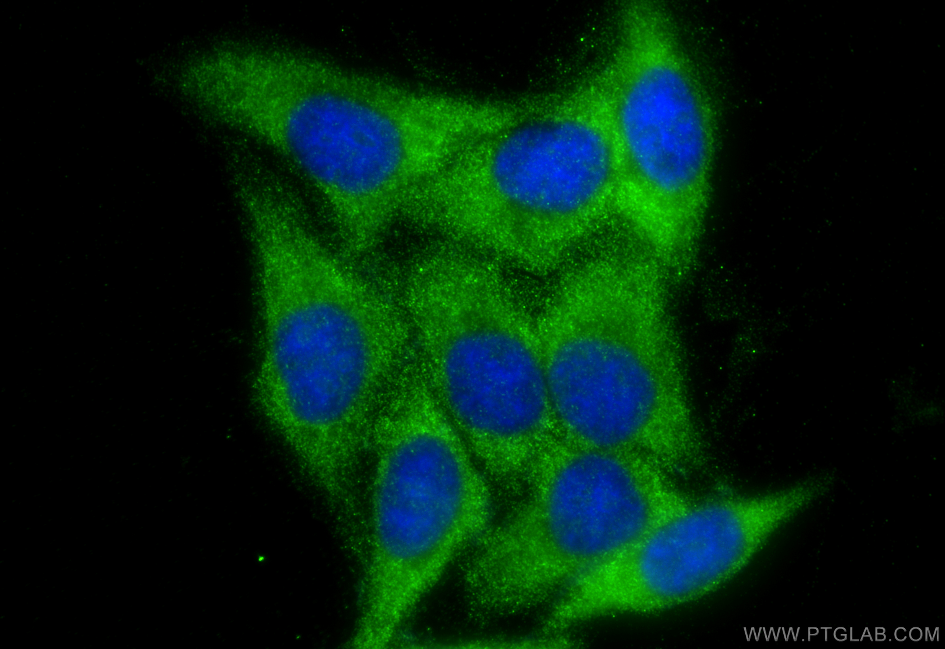 Immunofluorescence (IF) / fluorescent staining of HepG2 cells using Ch-TOG Polyclonal antibody (26457-1-AP)