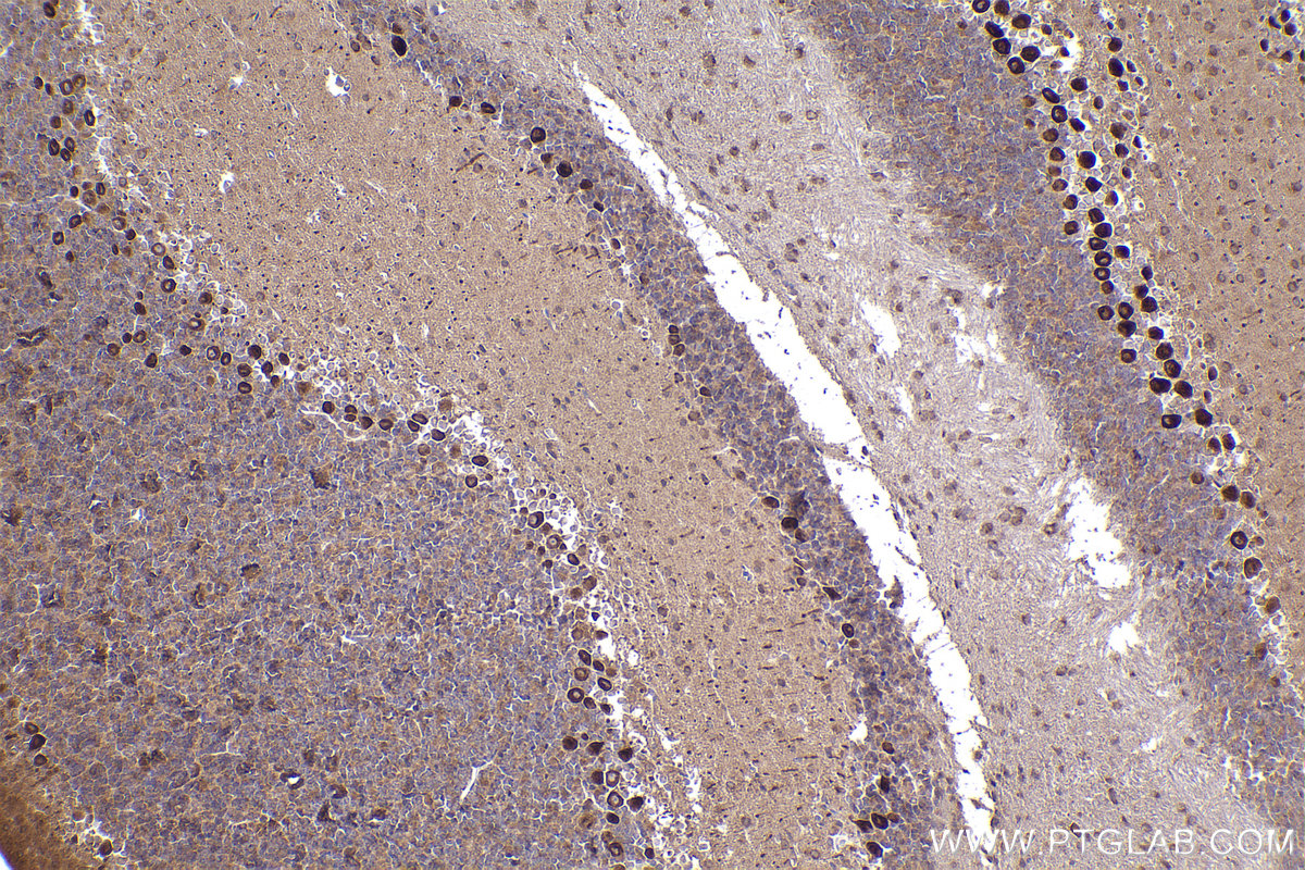 Immunohistochemistry (IHC) staining of mouse cerebellum tissue using Ch-TOG Monoclonal antibody (67631-1-Ig)