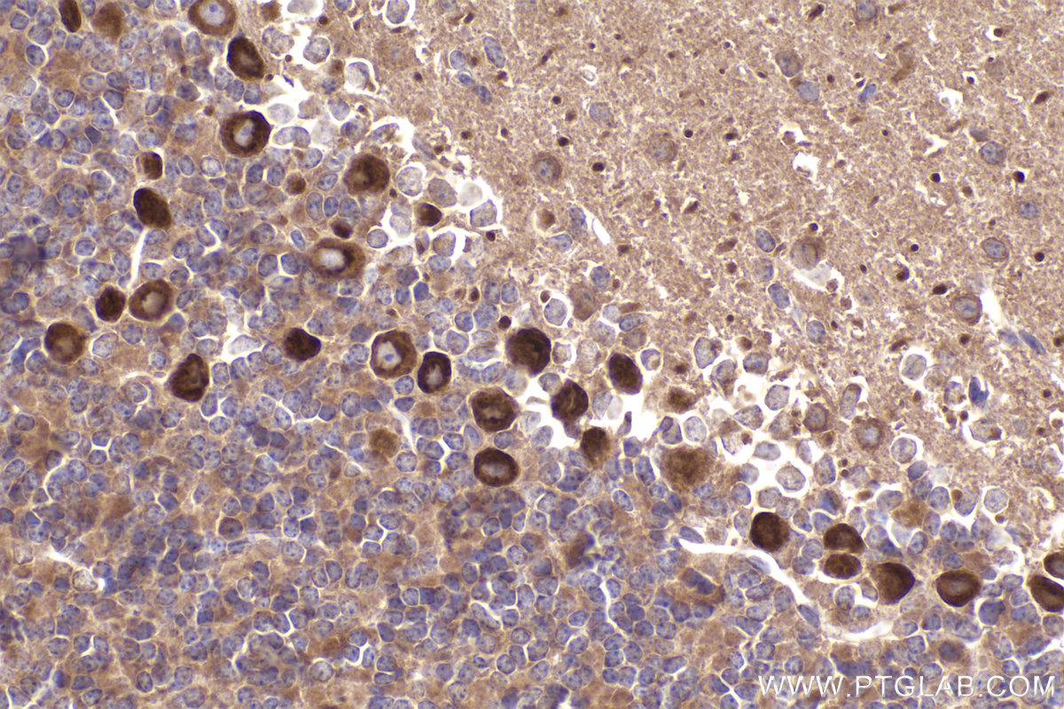 Immunohistochemistry (IHC) staining of mouse cerebellum tissue using Ch-TOG Monoclonal antibody (67631-1-Ig)