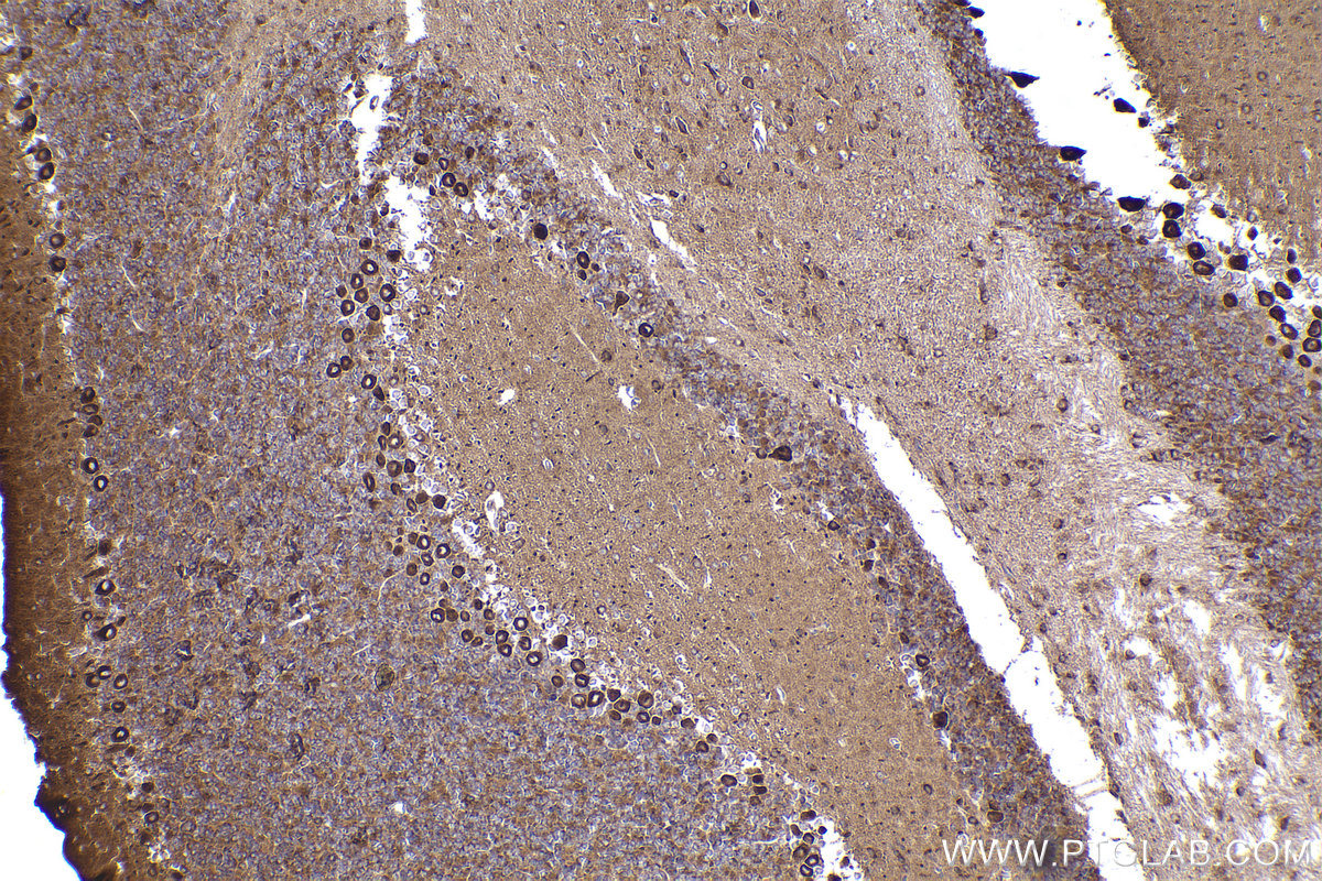 Immunohistochemistry (IHC) staining of mouse cerebellum tissue using Ch-TOG Recombinant antibody (84285-3-RR)