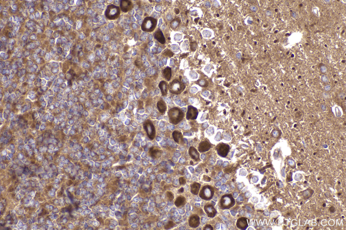 Immunohistochemistry (IHC) staining of mouse cerebellum tissue using Ch-TOG Recombinant antibody (84285-3-RR)