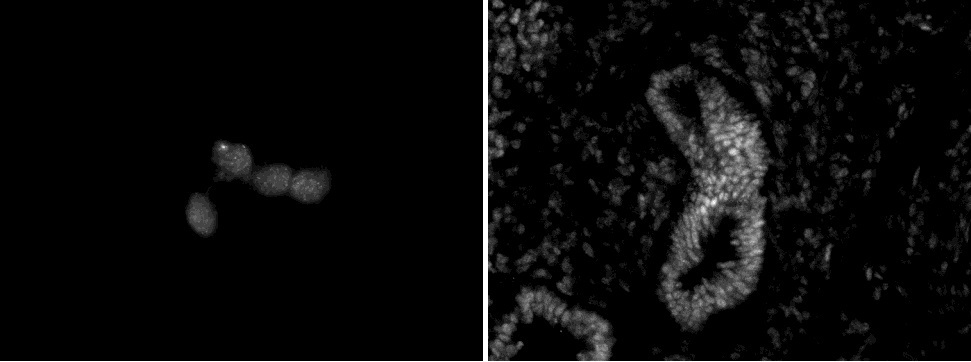 Chd5 antibody (mAb) (Clone 5A10) tested by immunofluorescence. Left: HeLa cells. Right: E12.5 mouse gut. Both stained with Chd5 antibody.